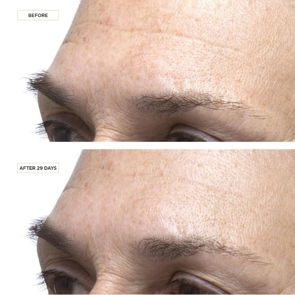 Perricone MD Cold Plasma+ Serum Concentrate - Picture 3 of 4